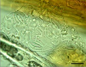 Eclipta prostrata (L.) L. - GlobinMed